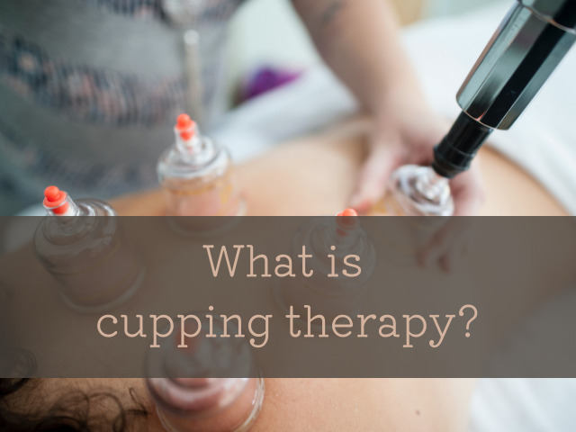 What is cupping therapy